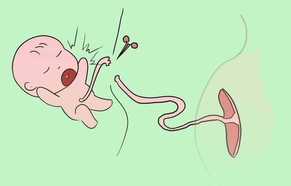 超声91视频污下载之新生儿脐带护理你做对了吗