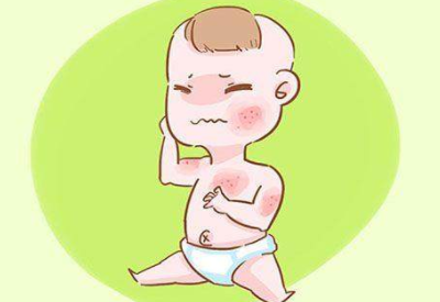 婴儿喝母乳起湿疹是怎么回事 婴儿喝母乳起湿疹是怎么回事
